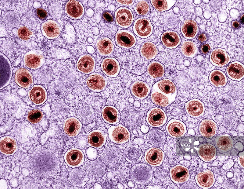 巨细胞病毒，TEM图片素材