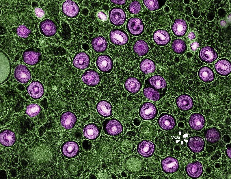 巨细胞病毒，TEM图片素材