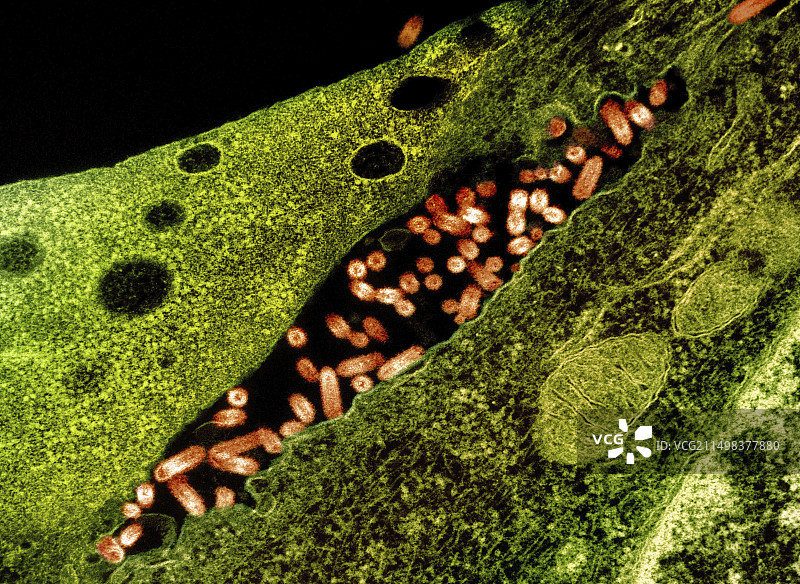 水疱性口炎病毒感染TEM图片素材