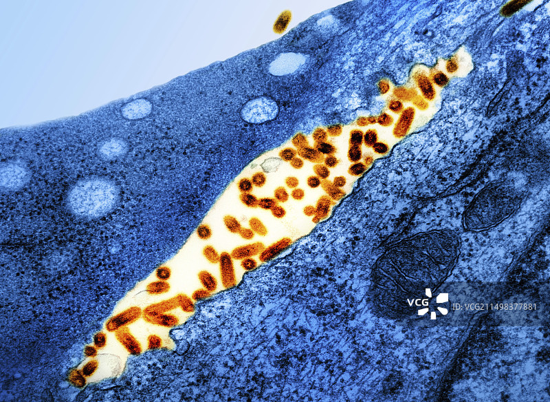 水疱性口炎病毒感染TEM图片素材