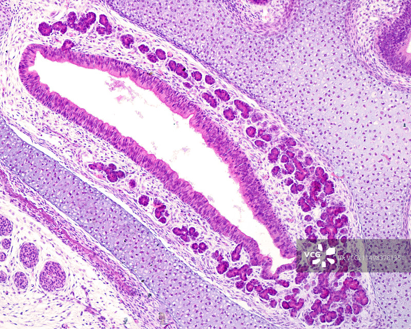 上颌窦发育，光学显微照片图片素材