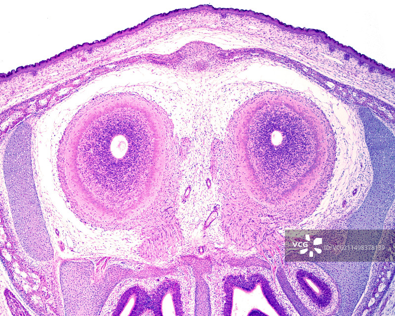 嗅球发育，光学显微照片图片素材