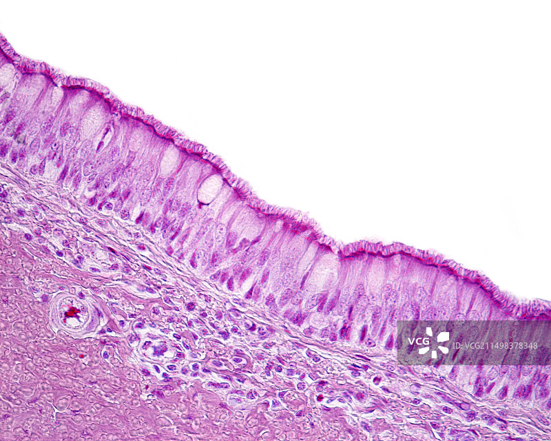呼吸道上皮细胞显微照片图片素材