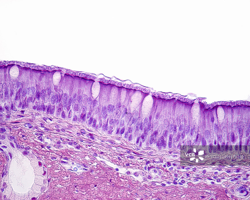 呼吸道上皮细胞显微照片图片素材