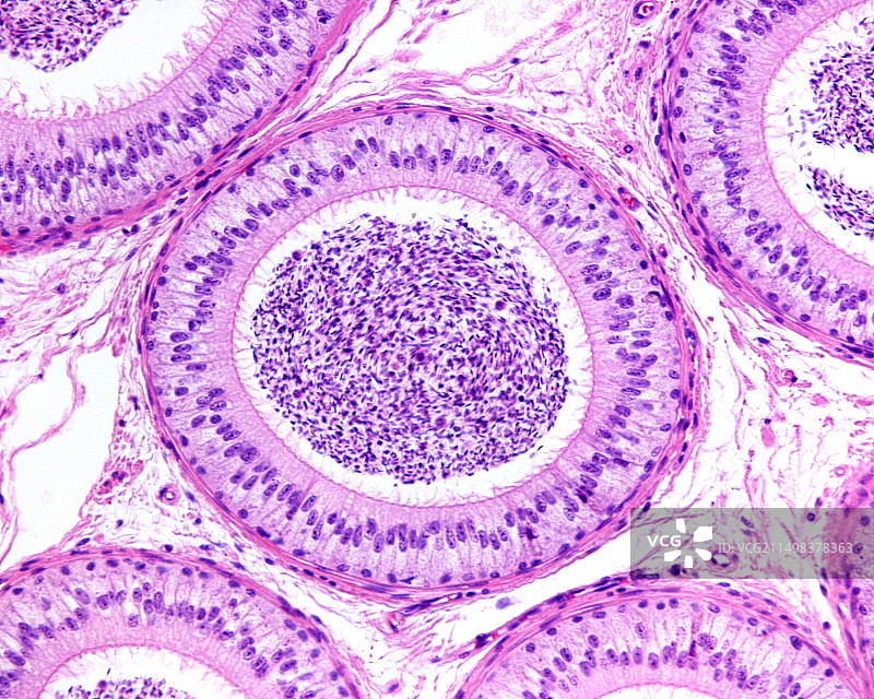 附睾假复层上皮，光学显微照片图片素材