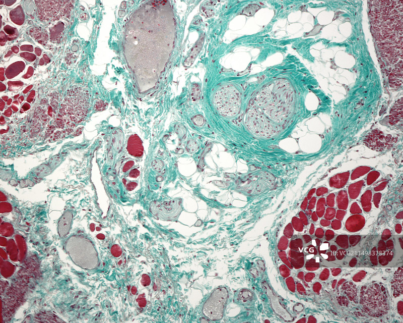 结缔组织，光学显微照片图片素材