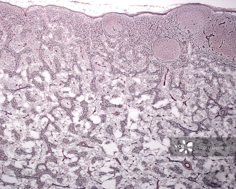 淋巴结网状纤维（光学显微照片）图片素材