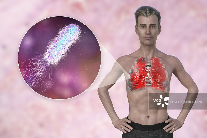 肺炎影响肺部的男人插画图片素材