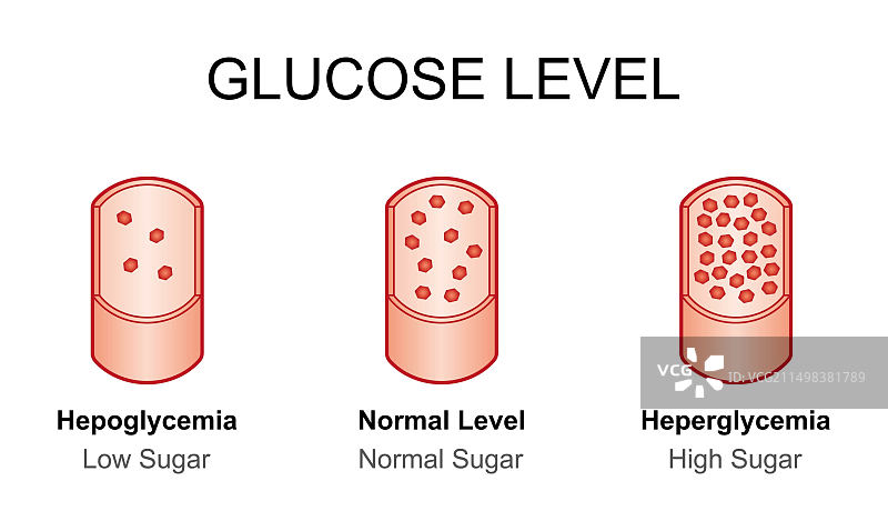 血糖水平图解图片素材