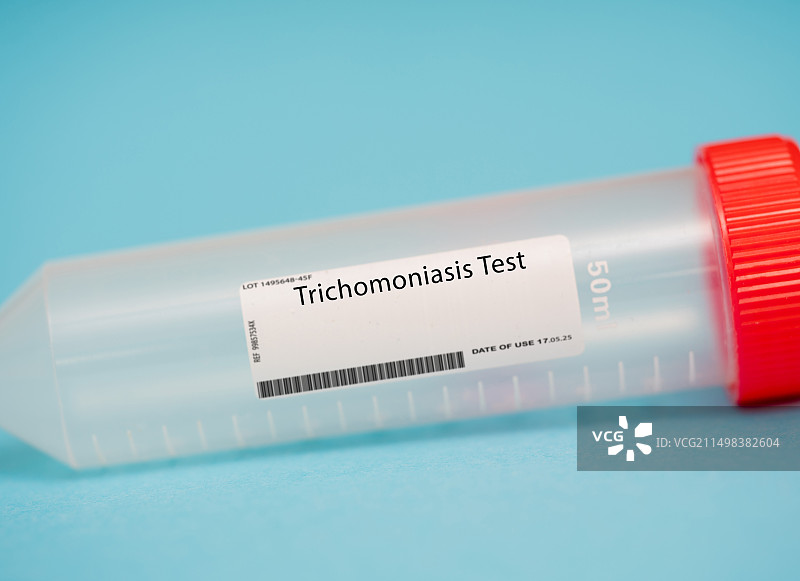 滴虫病测试图片素材