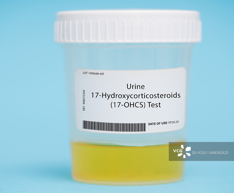 尿液17-羟皮质类固醇测试图片素材