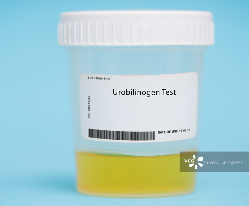 尿胆原测试图片素材