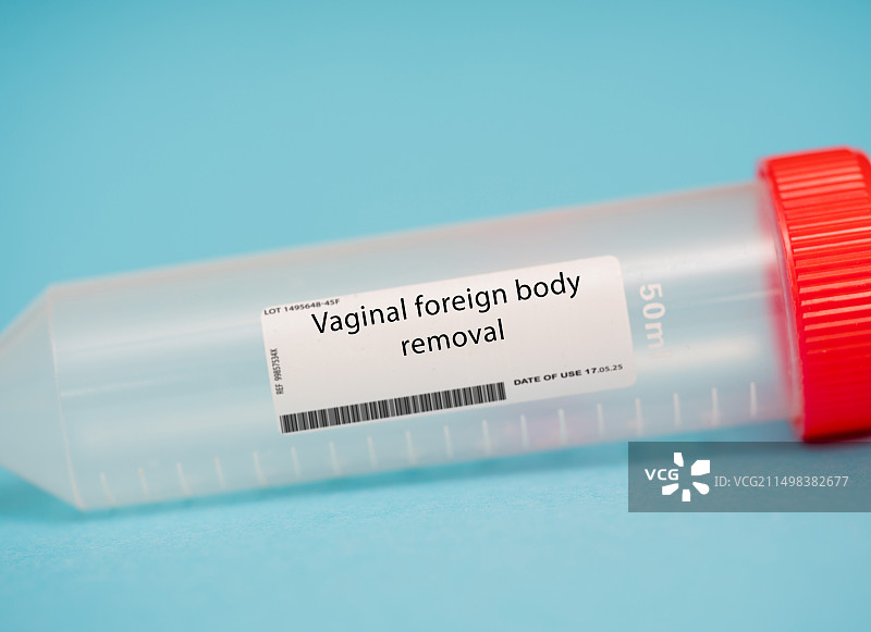 阴道异物移除图片素材