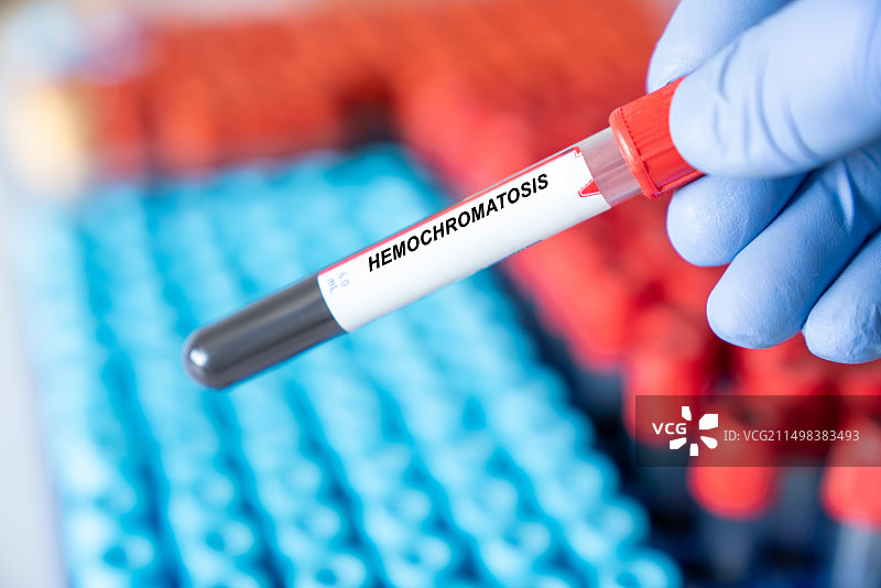 血色素沉着症血液检测图片素材