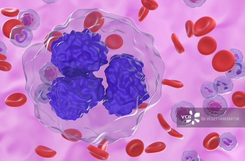 滤泡性淋巴瘤细胞图图片素材