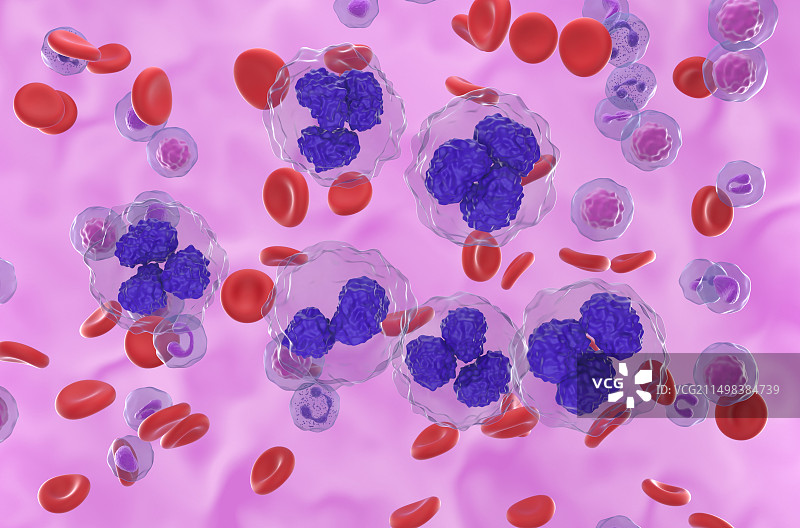 滤泡性淋巴瘤细胞图图片素材