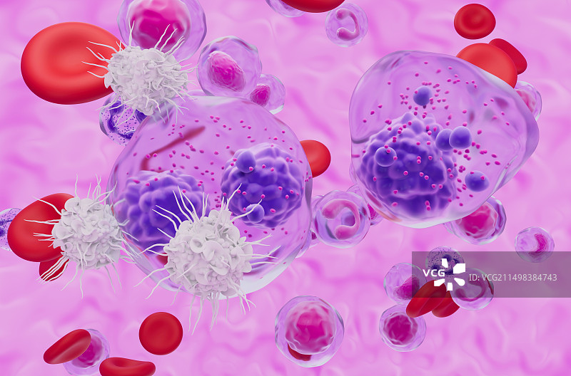 T细胞攻击多发性骨髓瘤细胞，图示图片素材