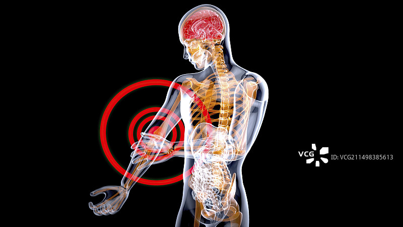 肘部疼痛概念图图片素材
