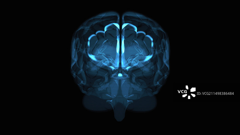 大脑扫描概念图图片素材