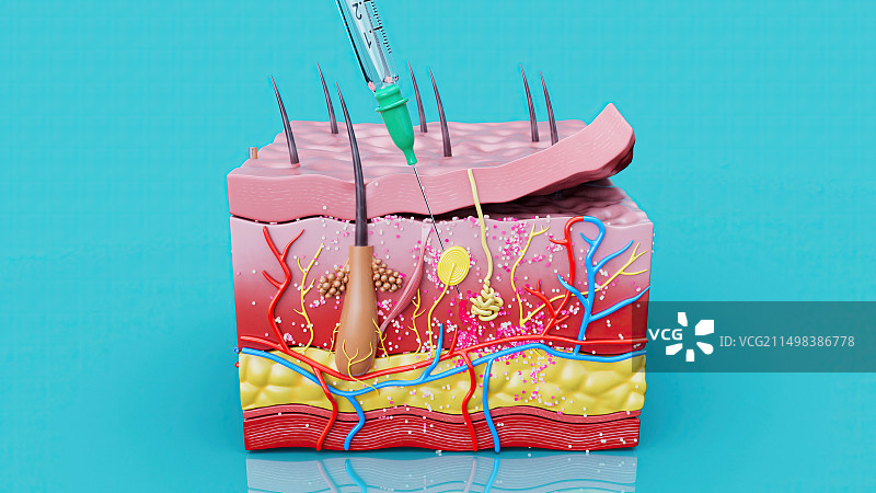 注射，图示图片素材
