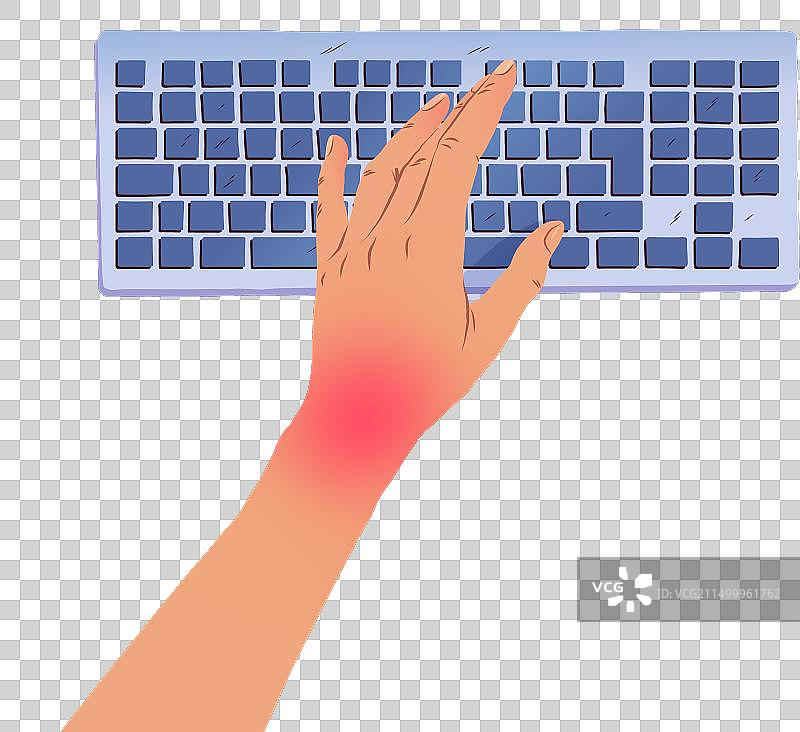 患腕管综合征的左手图片素材