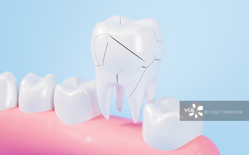 牙齿破碎牙齿整形牙齿修复概念3D渲染图片素材