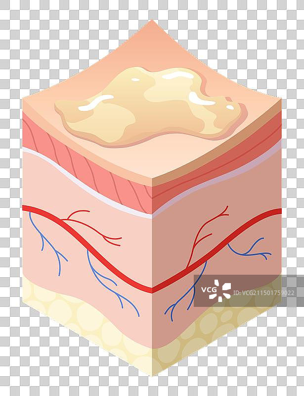 交叉的皮肤护理医学概念问题图片素材
