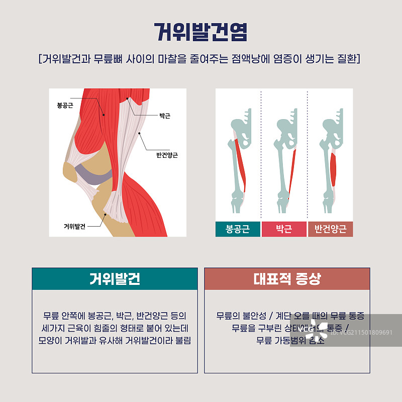 藜科植物肌腱炎，疾病，人体膝盖，炎症图片素材