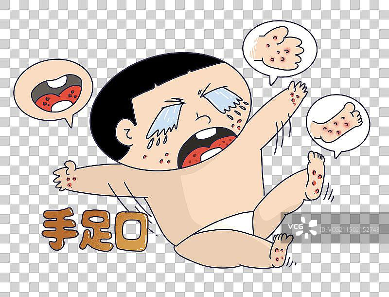 手足口病图片素材