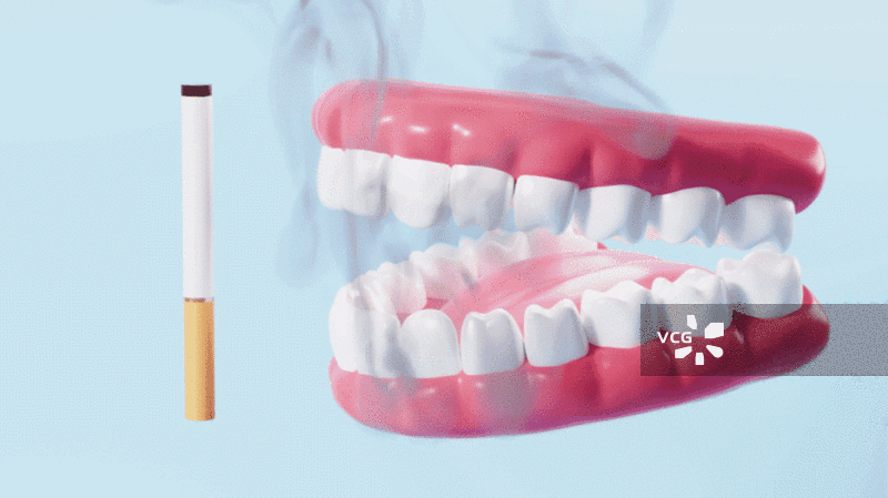 吸烟与牙齿口腔疾病概念动画图片素材