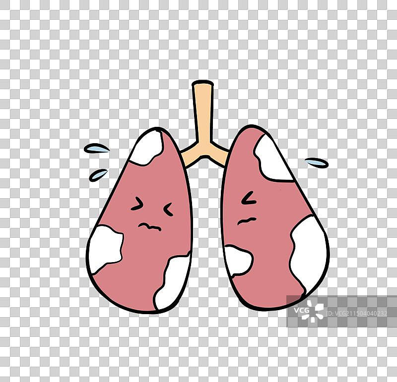 肺炎白肺图片素材