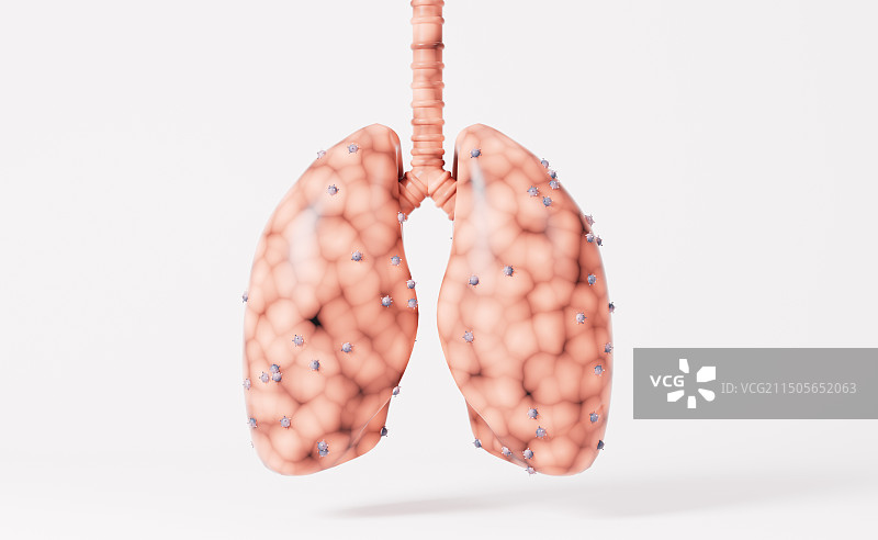 肺癌与感染病毒肺脏3D插画图片素材