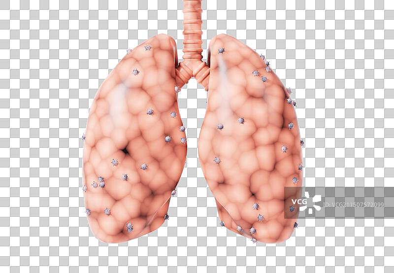 肺癌与感染病毒的肺脏3D元素插画图片素材