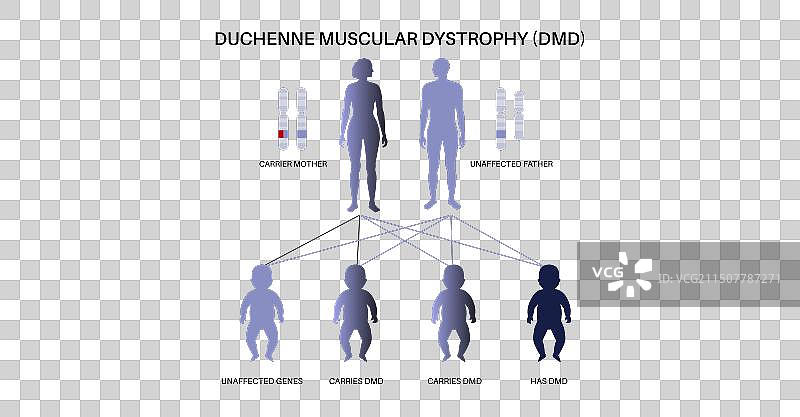 杜氏肌营养不良图片素材