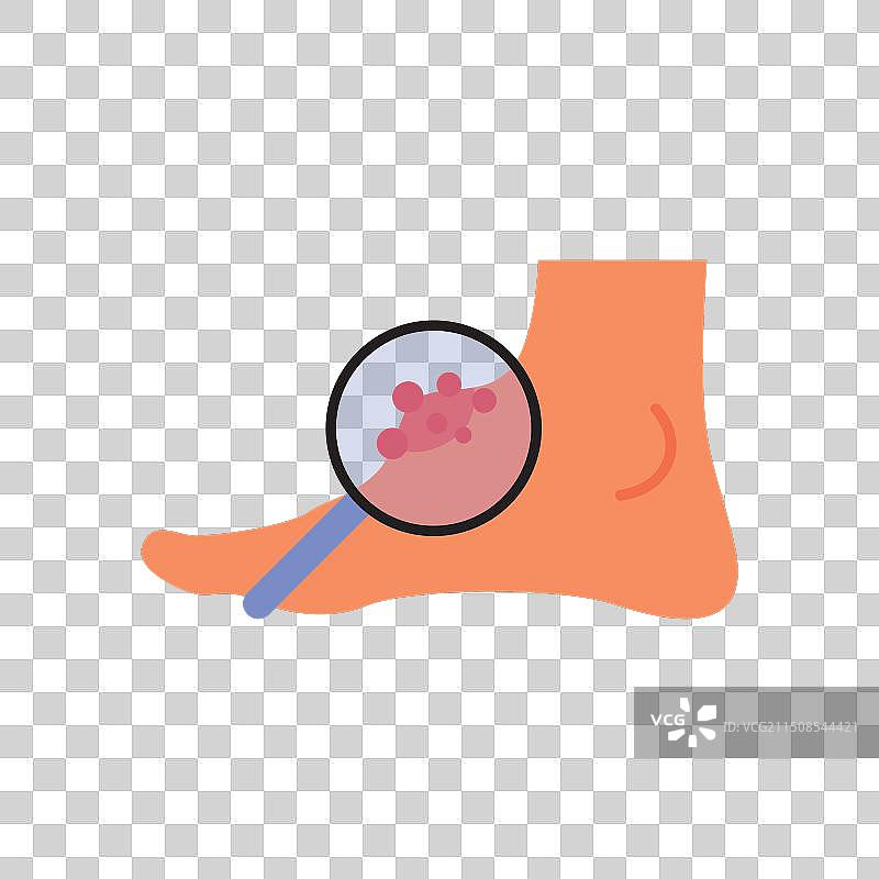 腿部水肿糖尿病和足部腿部肿胀图片素材