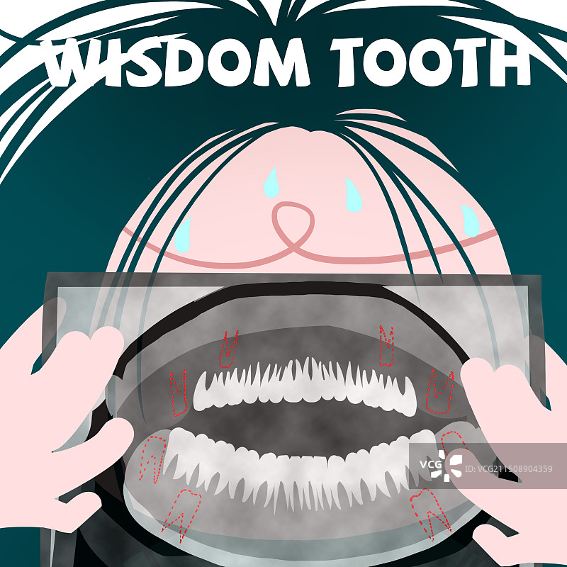 智齿的痛苦图片素材