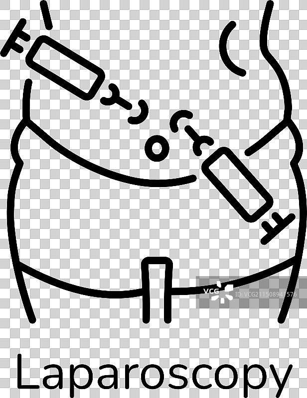 腹腔镜检查图片素材