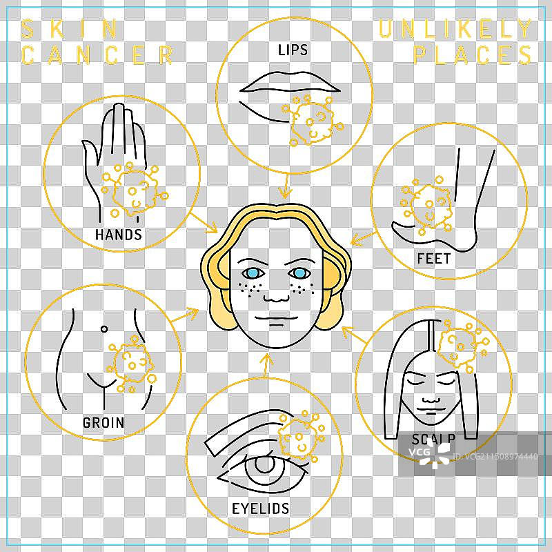 皮肤癌罕见部位竖版海报图片素材