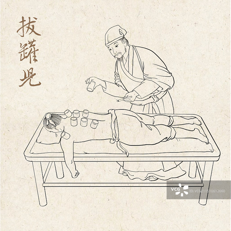 中医拔火罐拔罐疗法手绘插画图片素材