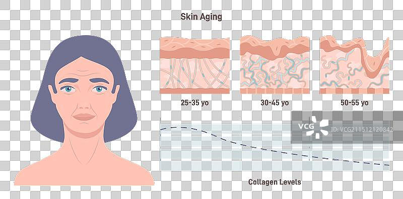 胶原蛋白水平降低的老化过程图片素材