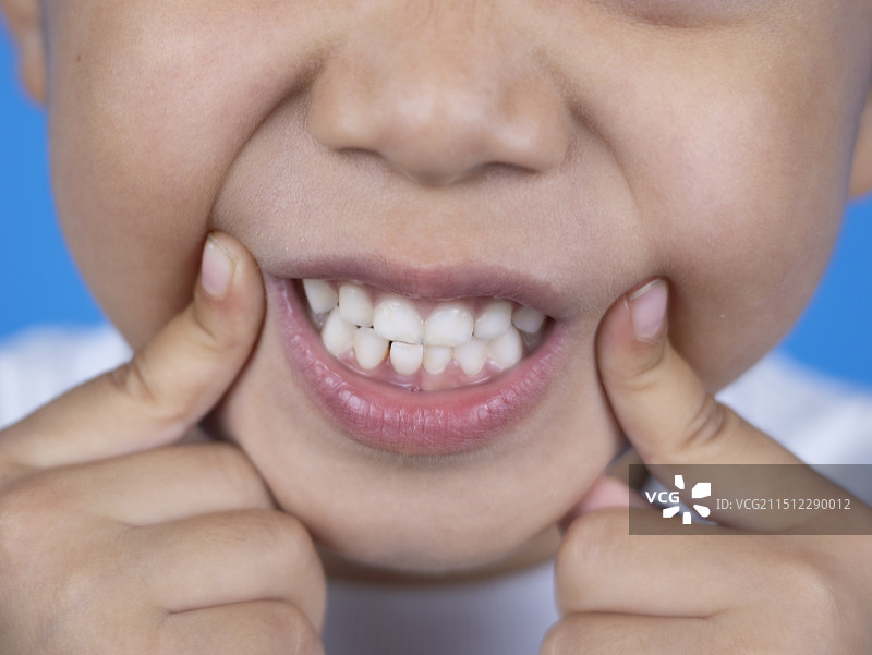 小朋友刷牙牙疼爱牙日图片素材