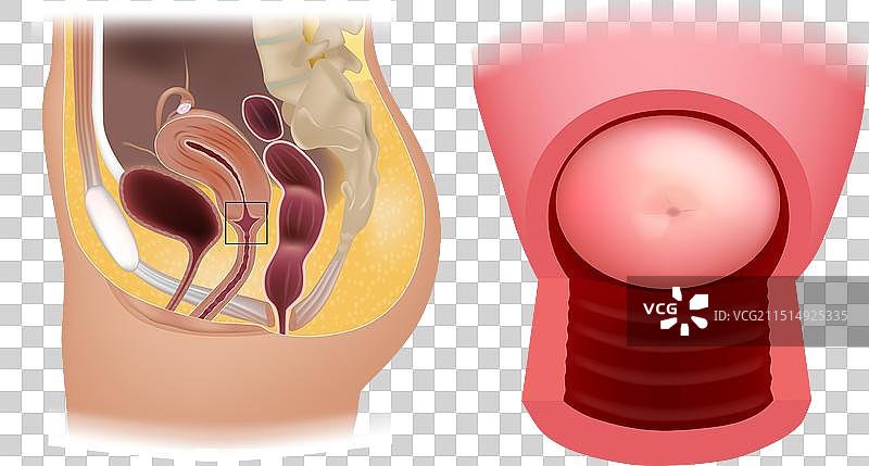 子宫颈解剖结构图片素材