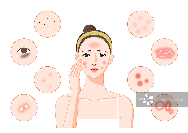 各种皮肤疾病图片素材