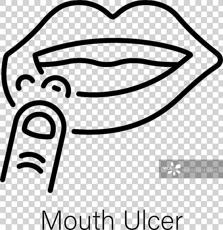 口腔溃疡图片素材