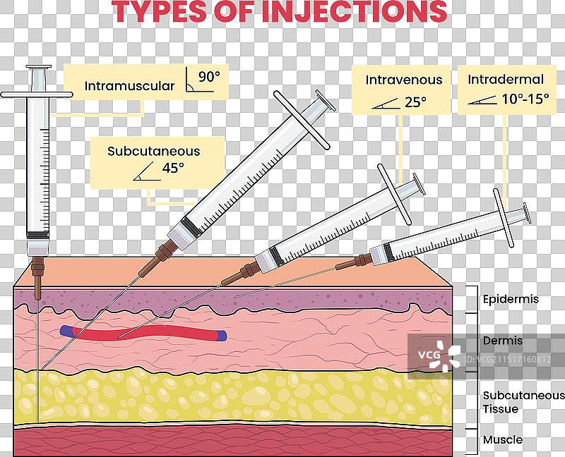 注射类型信息图图片素材