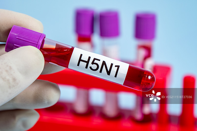 甲型H5N1禽流感病毒血样特写图片素材