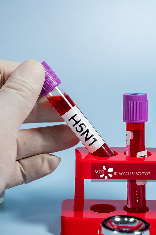 甲型H5N1禽流感病毒血样特写图片素材