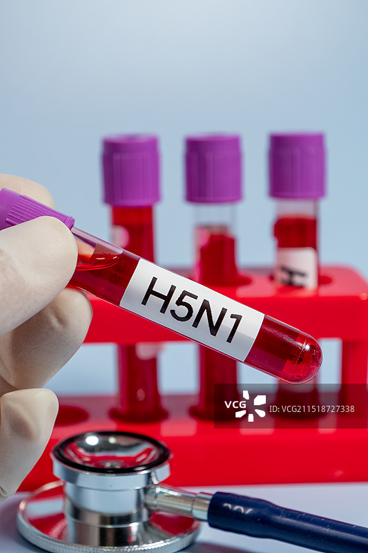 甲型H5N1禽流感病毒血样特写图片素材