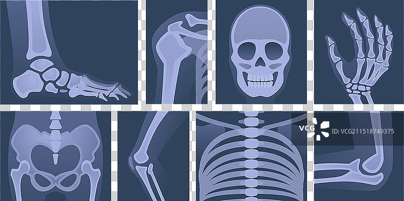 人体骨骼X光身体部位头骨图片素材