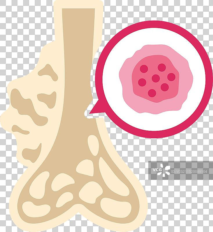 肉瘤和骨癌意识图片素材